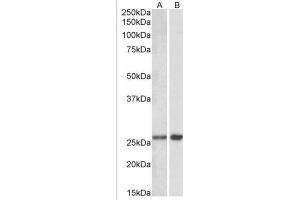 Staining of Mouse Brain lysate (A) and (1µg/ml) staining of Rat Brain lysate (B) using MOBKL3 antibody at 0. (MOBKL3 Antikörper  (Internal Region))