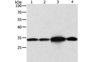 Western Blot analysis of Hela and Jurkat cell, Mouse brain tissue and 293T cell using NAPA Polyclonal Antibody at dilution of 1:500 (NAPA Antikörper)