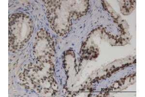 Immunoperoxidase of monoclonal antibody to ZNF3 on formalin-fixed paraffin-embedded human prostate. (ZNF3 Antikörper  (AA 1-110))