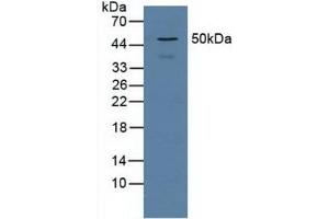 Figure. (Proteasome 26S Subunit, Non ATPase 5 (AA 143-341) Antikörper)