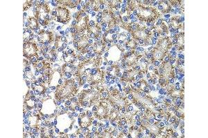 Immunohistochemistry of paraffin-embedded Rat kidney using COPS2 Polyclonal Antibody at dilution of 1:100 (40x lens). (COPS2 Antikörper)