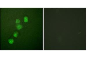 Immunofluorescence analysis of HuvEc cells, using Cyclin E1 (epitope around residue 395) antibody (ABIN5976158). (Cyclin E1 Antikörper  (Thr395))