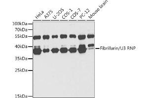 Fibrillarin anticorps  (AA 100-321)