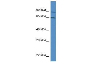 Western Blot showing MUS81 antibody used at a concentration of 1 ug/ml against Jurkat Cell Lysate (MUS81 Antikörper  (Middle Region))
