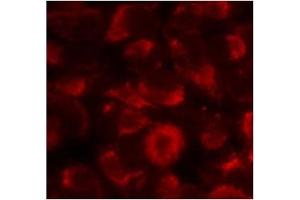 Image no. 2 for anti-Heat Shock Protein 90kDa alpha (Cytosolic), Class B Member 1 (HSP90AB1) (Ser254) antibody (ABIN197568)
