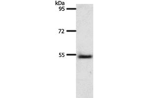 Western Blot analysis of Human liver cancer tissue using A1BG Polyclonal Antibody at dilution of 1:500 (A1BG Antikörper)