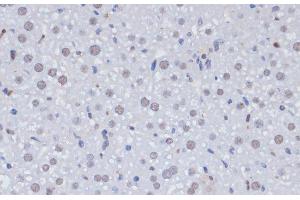Immunohistochemistry of paraffin-embedded Rat liver using PCNA Polyclonal Antibody at dilution of 1:100 (40x lens). (PCNA Antikörper)
