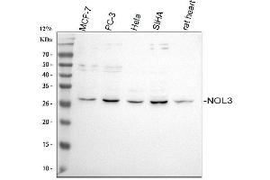 Western blot analysis of NOL3 using anti-NOL3 antibody (ABIN7599319).