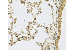Immunohistochemistry of paraffin-embedded Rat lung using PSMA5 Polyclonal Antibody at dilution of 1:100 (40x lens). (PSMA5 Antikörper)