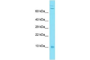 Host: Rabbit Target Name: C7orf49 Sample Type: MDA-MB-435S Whole Cell lysates Antibody Dilution: 1. (C7orf49 Antikörper  (N-Term))
