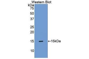 Western Blotting (WB) image for anti-TIMP Metallopeptidase Inhibitor 1 (TIMP1) (AA 35-160) antibody (ABIN1173100)
