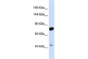 Host:  Rabbit  Target Name:  CDH23  Sample Type:  Fetal Brain lysates  Antibody Dilution:  1. (CDH23 Antikörper  (N-Term))