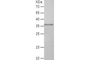 Western Blotting (WB) image for delta-Like 4 (DLL4) (AA 558-685) protein (His-IF2DI Tag) (ABIN7122629) (DLL4 Protein (AA 558-685) (His-IF2DI Tag))