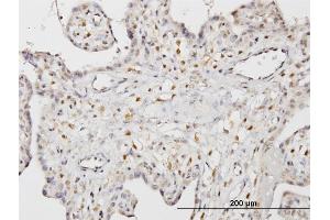 Immunoperoxidase of monoclonal antibody to STK33 on formalin-fixed paraffin-embedded human placenta.