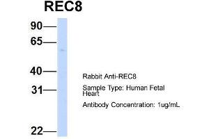 Host:  Rabbit  Target Name:  REC8  Sample Type:  Human Fetal Heart  Antibody Dilution:  1. (REC8 Antikörper  (N-Term))