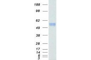 Western Blotting (WB) image for Sequestosome 1 (SQSTM1) (Transcript Variant 1) protein (Myc-DYKDDDDK Tag) (ABIN2712374)