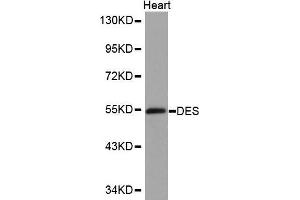 Western Blotting (WB) image for anti-Desmin (DES) (AA 121-470) antibody (ABIN3021115) (Desmin Antikörper  (AA 121-470))