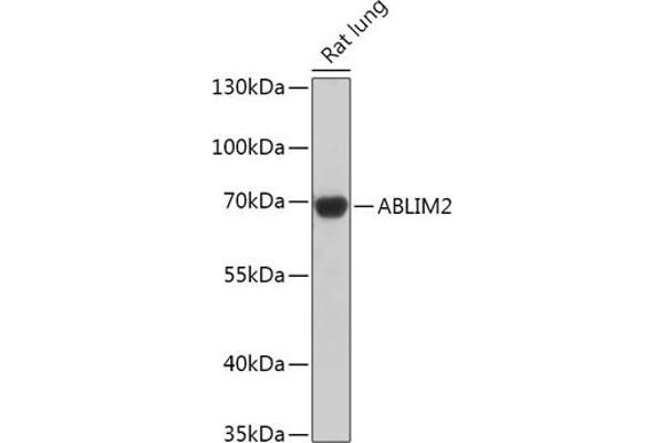 ABLIM2 anticorps  (AA 74-309)