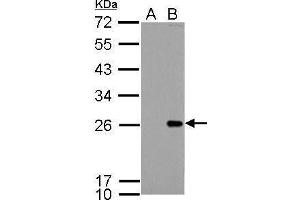 WB Image Bcl-2 antibody detects Bcl-2 protein by Western blot analysis.