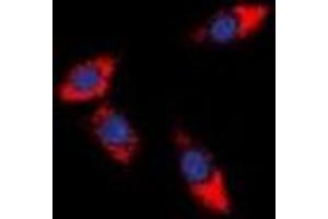 Immunofluorescent analysis of PDCD12 staining in HeLa cells.