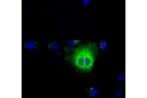 Anti-TBXAS1 mouse monoclonal antibody (ABIN2453709) immunofluorescent staining of COS7 cells transiently transfected by pCMV6-ENTRY TBXAS1 (RC208028). (TBXAS1 Antikörper)