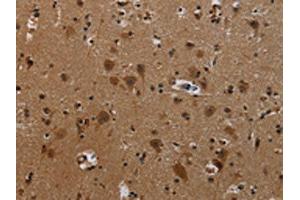 The image on the left is immunohistochemistry of paraffin-embedded Human brain tissue using ABIN7191807(PCDHB11 Antibody) at dilution 1/50, on the right is treated with synthetic peptide. (PCDHB11 Antikörper)