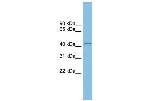 CLEC4M antibody used at 1 ug/ml to detect target protein. (C-Type Lectin Domain Family 4, Member M (CLEC4M) (Middle Region) Antikörper)