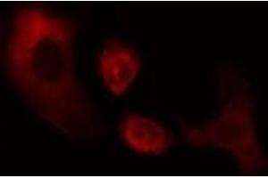 ABIN6274966 staining Hela cells by IF/ICC.