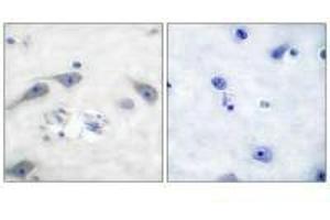 Immunohistochemical analysis of paraffin-embedded human brain tissue using DARPP-32 (Ab-75) antibody. (DARPP32 Antikörper  (Thr75))