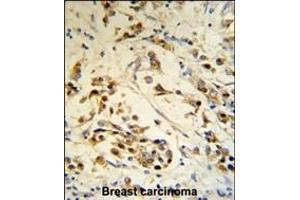 Immunohistochemistry (Paraffin-embedded Sections) (IHC (p)) image for anti-RNA Binding Motif Protein 3 (RBM3) (AA 55-84) antibody (ABIN391593)