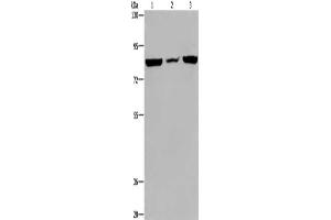 Gel: 6 % SDS-PAGE, Lysate: 40 μg, Lane 1-3: A549 cells, mouse heart tissue, Hela cells, Primary antibody: ABIN7130075(LEPREL2 Antibody) at dilution 1/300, Secondary antibody: Goat anti rabbit IgG at 1/8000 dilution, Exposure time: 20 seconds