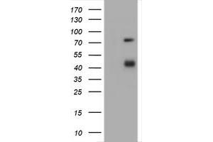 Image no. 1 for anti-CD2 (CD2) antibody (ABIN1497197) (CD2 Antikörper)