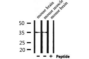 Western blot analysis of extracts from mouse brain and mouse muscle, using OR52P1 Antibody. (OR52P1 Antikörper)
