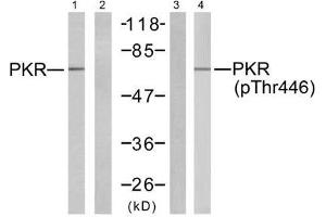 Western blot analysis of extracts from K562 cells, using PKR (Ab-446) antibody (E021272, Line 1 and 2) and PKR (phospho-Thr446) antibody (E011280, Line 3 and 4). (EIF2AK2 Antikörper)