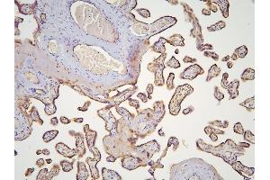 IHC analysis of HOOK3 using anti-HOOK3 antibody (ABIN6719547). (HOOK3 Antikörper  (AA 14-198))
