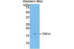 Western blot analysis of the recombinant protein. (CD70 Antikörper  (AA 64-192))