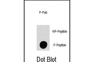 Dot blot analysis of anti-P4K4-p Phospho-specific Pab (R) on nitrocellulose membrane.