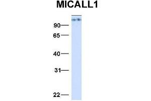 Host:  Rabbit  Target Name:  MICALL1  Sample Type:  293T  Antibody Dilution:  1. (MICAL-Like 1 Antikörper  (N-Term))