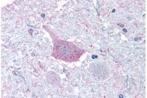 Immunohistochemical staining of human brain, medulla with MRGPRD polyclonal antibody . (MRGPRD Antikörper  (Cytoplasmic Domain))