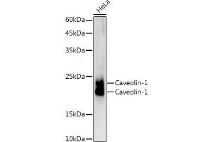 Western blot analysis of extracts of HeLa cells, using Caveolin-1 antibody (ABIN7266154) at 1:1000 dilution. (Caveolin-1 Antikörper)