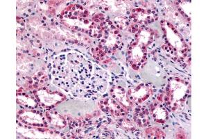 Anti-GPR91 antibody IHC of human kidney. (SUCNR1 Antikörper  (C-Term))