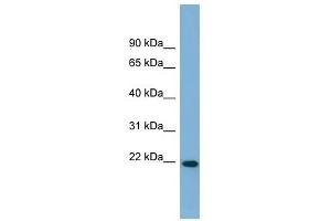 FNDC4 antibody used at 1 ug/ml to detect target protein. (FNDC4 Antikörper  (Middle Region))