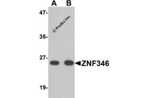 Western Blotting (WB) image for anti-Zinc Finger Protein 346 (ZNF346) (N-Term) antibody (ABIN1031685) (ZNF346 Antikörper  (N-Term))