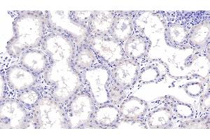 Detection of aHSP in Human Kidney Tissue using Monoclonal Antibody to Alpha-Hemoglobin Stabilizing Protein (aHSP) (aHSP Antikörper  (AA 1-102))