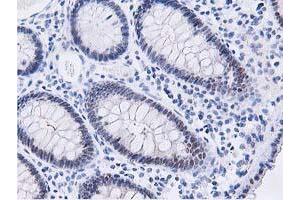 Immunohistochemical staining of paraffin-embedded Human colon tissue using anti-DPP3 mouse monoclonal antibody.