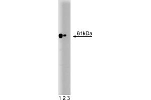 Western Blotting (WB) image for anti-Calcineurin (CAN) (AA 247-449) antibody (ABIN967861)