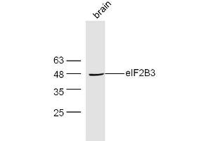 Mouse brain lysates probed with Rabbit Anti-EIF2B3 Polyclonal Antibody, Unconjugated  at 1:300 overnight at 4˚C. (EIF2B3 Antikörper  (AA 101-200))