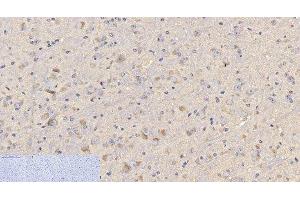 Immunohistochemistry of paraffin-embedded Mouse brain tissue using CD4 Monoclonal Antibody at dilution of 1:200. (CD4 Antikörper)