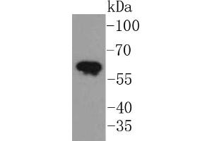 A431 lysates, probed with Cytokeratin 5 (2H5) Monoclonal Antibody  at 1:1000 overnight at 4˚C. (Cytokeratin 5 Antikörper)