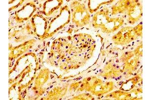 IHC image of ABIN7160954 diluted at 1:200 and staining in paraffin-embedded human kidney tissue performed on a Leica BondTM system.